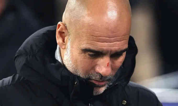 Guardiola đính chính vụ `tự làm đau bản thân`