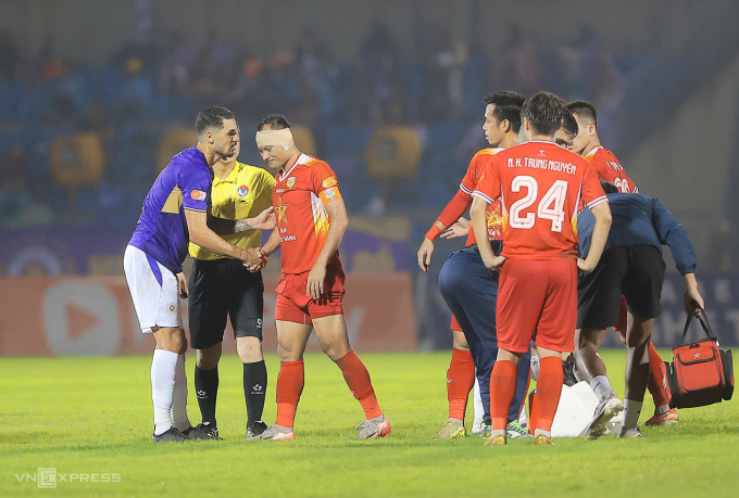 Trọng Hoàng bị giẫm rách tai ở V-League