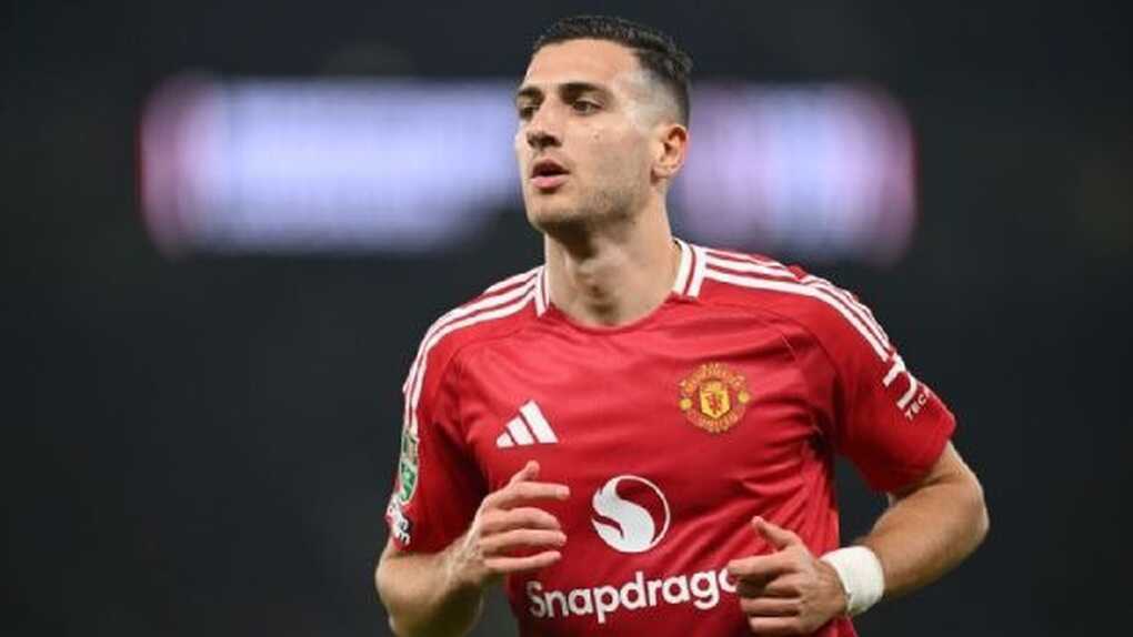 Man Utd nhận tổn thất lớn trước màn so tài với Man City