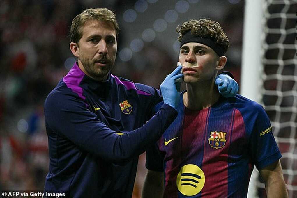 Ngôi sao Barcelona lĩnh trọn cú đạp vào mặt, Yamal không dám chứng kiến - 3